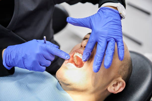 Best Emergency Dentist for Knocked-Out Tooth in New Boston, OH